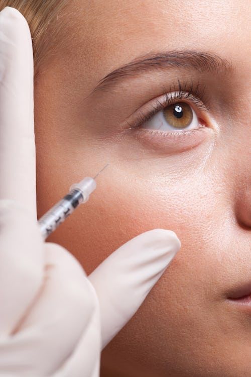 Avastin (anti-VEGF) eye injection